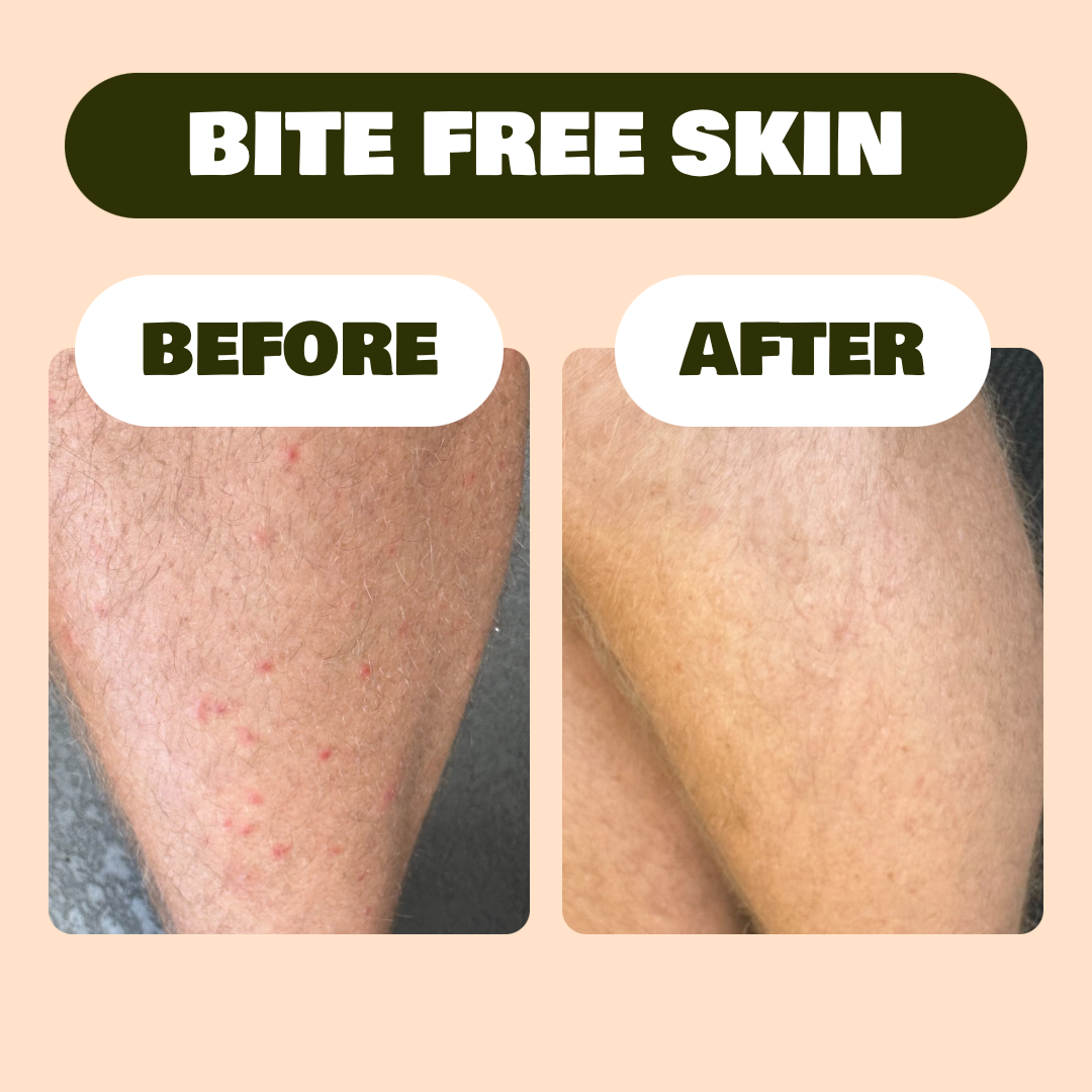 Patch Bite Relief Spots